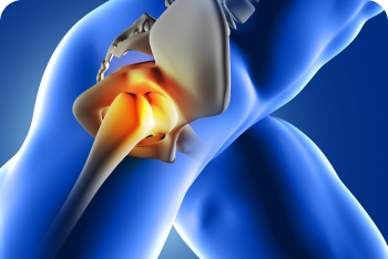 hip replacement